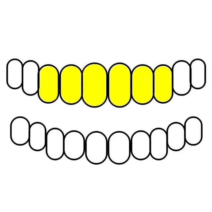 Bling Cartel Admin PreStyled Sets Real 10k Gold Full DiamondDust Custom Teeth Grillz