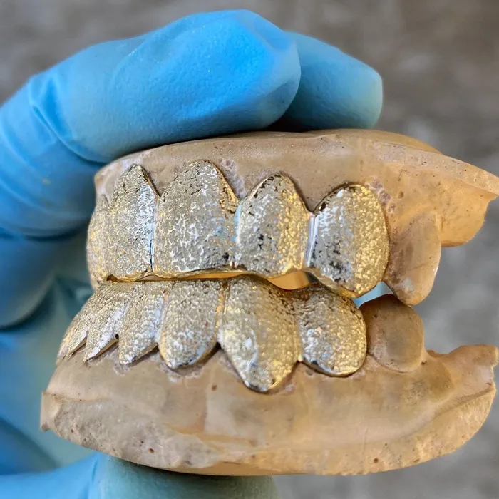 Bling Cartel Admin PreStyled Sets Real 10k Gold Full DiamondDust Custom Teeth Grillz